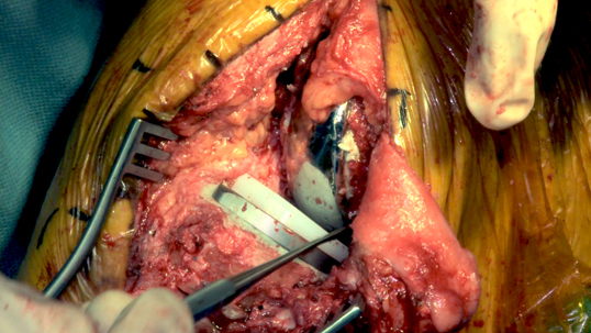 live surgical video